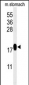 TXNDC12 Antibody (C-term)